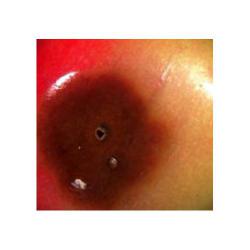 Rhagoletis cerasi, plaga